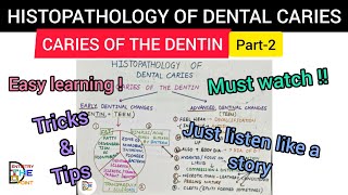 HISTOPATHOLOGY OF DENTAL CARIES  CARIES OF THE DENTIN PART2 [upl. by Ikram]