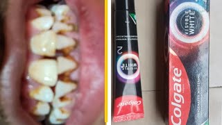 Colgate visible white toothpaste review and unboxing [upl. by Shay525]