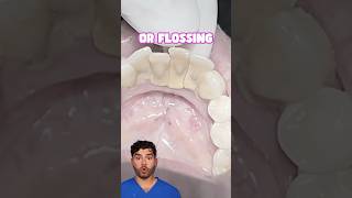 Teeth Cleaning Explained [upl. by Wendie]