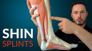 Understanding SHIN SPLINTS and how to fix it [upl. by Blanka]