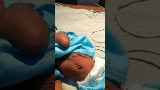 Medical Education Video Neonatology Severe dehydration in newborn  poor skin turgor [upl. by Aneek]