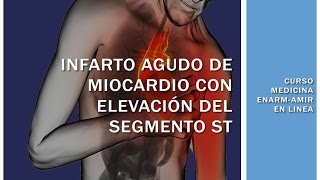 INFARTO AGUDO AL MIOCARDIO CON ELEVACIÓN DEL ST [upl. by Ahsiekal50]