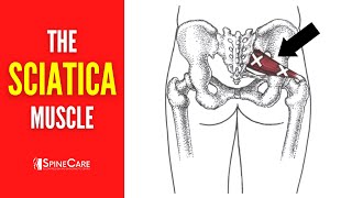 The Sciatica Muscle How to Release It for INSTANT RELIEF [upl. by Nadnal]