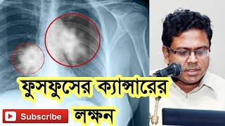 ফুসফুসের ক্যান্সারের লক্ষন। Symptoms of Lung Cancer [upl. by Portingale930]