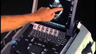 How to Echocardiography  Subcostal View [upl. by Bascio]