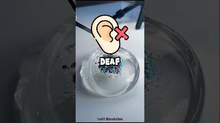 How Do I Even Roast Deaf People 🤣 tylervitelli funny shorts viralshorts [upl. by Donica637]