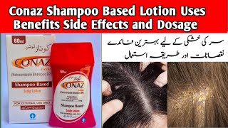 Conaz Shampoo for Dandruff and Hair Fall  Best Anti Dandruff Shampoo  Ketoconazol shampoo Benefits [upl. by Noisla]