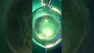 Embryo Transfer Explained  Dr Pallavi Tiple amp RJ Bandya [upl. by Aduhey]