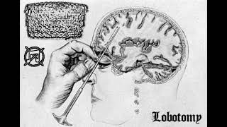 ESUTIFOTTFCQSAFL  Lobotomy [upl. by Eednil]