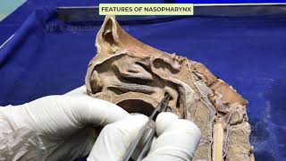 Pharynx I  Internal features [upl. by Idnis]