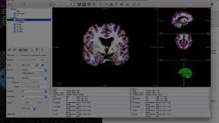 FreeSurfer FreeView Demo [upl. by Rech]
