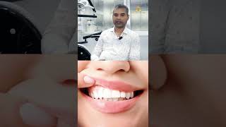 Danto Me Sensitivity1 Sensitivity cavities medical knowledge dental problems oralhealthtips [upl. by Anaicilef]