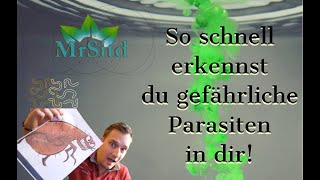 Parasiten im Körper  einfach schnell erkennen [upl. by Yerac292]