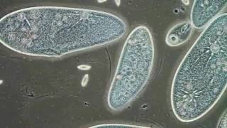 Paramecia Contractile Vacuoles by Edwin Lee [upl. by Esdras993]