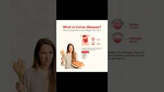 What is celiac disease celiacdisease foodlist glutenfree nutritiontips [upl. by Darton]