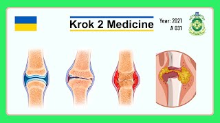 Krok 2 Medicine  Year 2021  031 Ministry of Public Health of Ukraine [upl. by Khano]