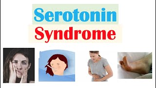 Serotonin Syndrome  Causes Medications Pathophysiology Signs amp Symptoms Diagnosis Treatment [upl. by Rich353]