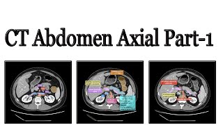 CT Scan of abdomen part 1 [upl. by Hanauq]