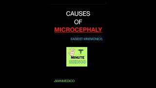 MICROCEPHALY CAUSES  PEDIATRICS EASIEST MNEMONIC 5MINMEDICO next neetpg shorts [upl. by Atilol]