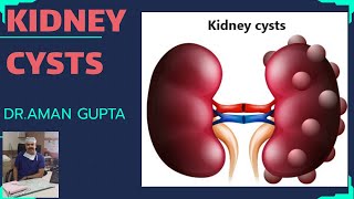 Renal or Kidney CystsSymptomsCauseTreatment [upl. by Elbertine]