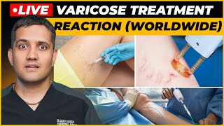 My Reaction on Venaseal Sclerotherapy amp Laser Treatment for varicose veins  Dr Gaurav G IR [upl. by Estrella812]