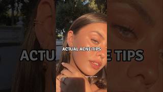 6 Actual Acne Tips viralshorts acnetreatment acnescars [upl. by Holsworth]