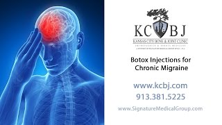 Botox Injections for Treatment of Chronic Migraine [upl. by Tadich]