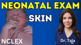 How to examine babys skin Neonatologist reviews NCLEX 7 [upl. by Atineb]