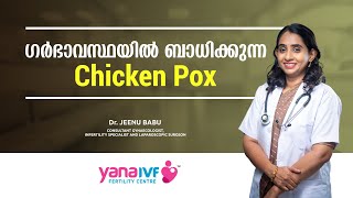 സൂക്ഷിക്കണം ചിക്കൻപോക്സിനെ  Chickenpox and Pregnancy  Malayalam  Pregnancy Care [upl. by Allehc685]