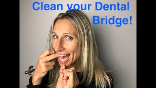 How to Clean Your Dental Bridge [upl. by Kellby]