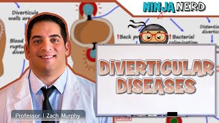 Diverticular Diseases  Clinical Medicine [upl. by Ayanaj]