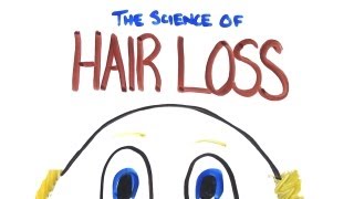 The Science of Hair LossBalding [upl. by Niel987]