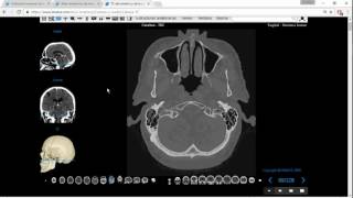 Tomografía Computada de Cabeza para Anatomía Parte 1 [upl. by Fabe]