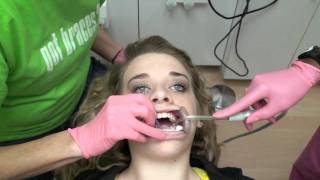 Nice Teeth Bro Removal of Braces [upl. by Rhodes]