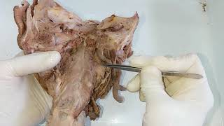 Dissection  Constrictors of Pharynx [upl. by Sidra]