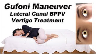 Gufoni Maneuver to Treat BPPV of the Lateral Canal Ageotropic and Geotropic Variations [upl. by Iggam802]