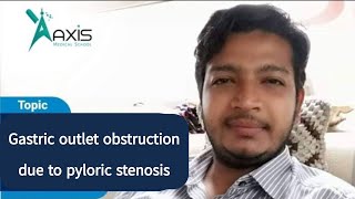 Gastric Outlet Obstruction due to Pyloric Stenosis [upl. by Ebonee]