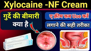 Xylocaine NF Cream  गुदे के की बीमारी में जरूर use करे  गुदे दर्द खुजलीफटनालॉलीपन के लिए [upl. by Meurer560]