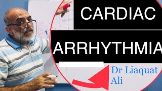 Cardiac Arrhythmia and Types  Urdu amp Hindi  Dr Liaquat Ali Mehr [upl. by Ibmab]