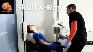 XRay Positioning  Skull SMV view ☢️ YourXRayTech [upl. by Ytsihc529]