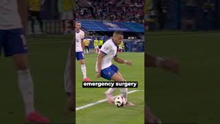 Mbappe to undergo surgery and wear a mask [upl. by Chlori]