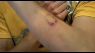 Landlord Bit My Arm  Bizarre ER [upl. by Anaihsat]