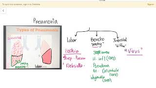 Types of Pneumonia  Lobar  Bronchopneumonia  Interstitial  Diffuse [upl. by Lorraine]