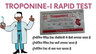 TroponinI Test  Cardiac Troponin I [upl. by Las653]