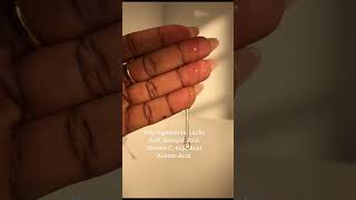 Watch this if you want to get rid of your dark spots [upl. by Adlesirg]