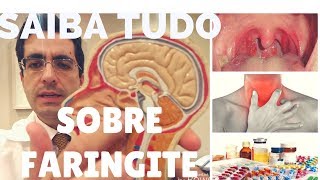 FARINGITE O QUE É  QUAIS SÃO AS CAUSAS E COMO PREVENIR Dr Paulo Mendes Jr Otorrino em Curitiba [upl. by Dorice]