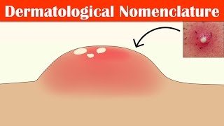 Describing Skin Lesions Dermatological Nomenclature  Macule Papule Pustule Vesicle amp Others [upl. by Drol29]