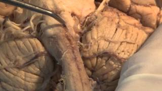 The Most Important Pathway Motor Control Neuroanatomy Video Lab  Brain Dissections [upl. by Fondea527]