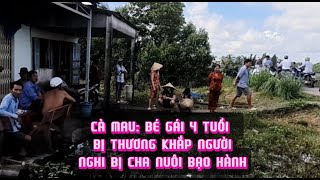 Cà Mau Bé gái 4 tuổi bị thương khắp người nghi bị cha nuôi bạo hành [upl. by Flemming]