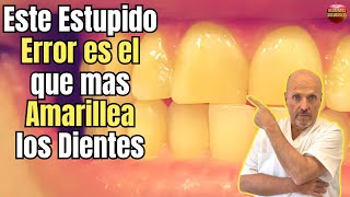 🆘 ESTE ESTUPIDO ERROR ES EL QUE MAS PONE LOS DIENTES AMARILLOS 🆘 [upl. by Aremat698]